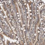 CLCN2 Antibody in Immunohistochemistry (Paraffin) (IHC (P))