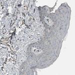 CLCN2 Antibody in Immunohistochemistry (Paraffin) (IHC (P))