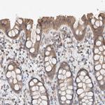 UGCG Antibody in Immunohistochemistry (IHC)