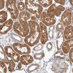 UGCG Antibody in Immunohistochemistry (IHC)