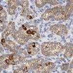 HDHD3 Antibody in Immunohistochemistry (IHC)