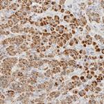 HDHD3 Antibody in Immunohistochemistry (IHC)