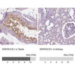 SPATA31E1 Antibody in Immunohistochemistry (IHC)