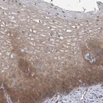 FAM83H Antibody in Immunohistochemistry (IHC)