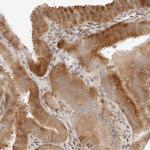 GEM Antibody in Immunohistochemistry (IHC)