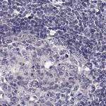 KIF13B Antibody in Immunohistochemistry (IHC)