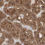 KIF13B Antibody in Immunohistochemistry (IHC)