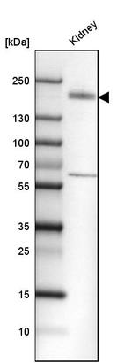 KIF13B Antibody in Western Blot (WB)