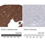 ACOT7 Antibody in Immunohistochemistry (IHC)