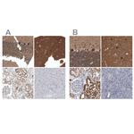 ACOT7 Antibody in Immunohistochemistry (IHC)