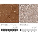CAMSAP2 Antibody in Immunohistochemistry (IHC)