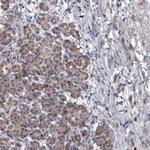 DBT Antibody in Immunohistochemistry (IHC)