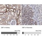 DBT Antibody