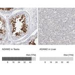 ADAM2 Antibody in Immunohistochemistry (IHC)