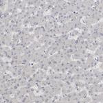 ADAM2 Antibody in Immunohistochemistry (IHC)