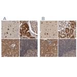 TRMT61B Antibody in Immunohistochemistry (IHC)