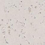 SLC25A26 Antibody in Immunohistochemistry (IHC)