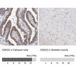 CDK20 Antibody in Immunohistochemistry (IHC)