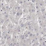 UFC1 Antibody in Immunohistochemistry (IHC)