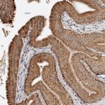 PEX2 Antibody in Immunohistochemistry (IHC)