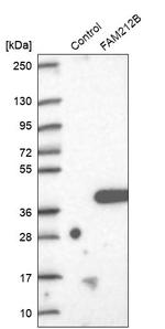 FAM212B Antibody in Western Blot (WB)