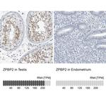 ZPBP2 Antibody in Immunohistochemistry (IHC)