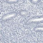 ZPBP2 Antibody in Immunohistochemistry (IHC)