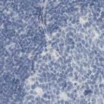 ZPBP2 Antibody in Immunohistochemistry (IHC)