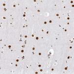 DHX9 Antibody in Immunohistochemistry (Paraffin) (IHC (P))