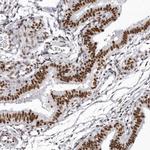 DHX9 Antibody in Immunohistochemistry (Paraffin) (IHC (P))