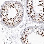 DHX9 Antibody in Immunohistochemistry (Paraffin) (IHC (P))