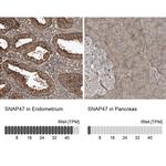 SNAP47 Antibody in Immunohistochemistry (IHC)