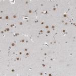 C8orf58 Antibody in Immunohistochemistry (Paraffin) (IHC (P))