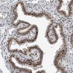 C8orf58 Antibody in Immunohistochemistry (Paraffin) (IHC (P))