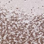 C1orf77 Antibody in Immunohistochemistry (Paraffin) (IHC (P))