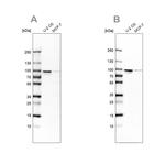 ENAH Antibody in Western Blot (WB)