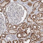 MRPL18 Antibody in Immunohistochemistry (IHC)