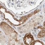 LRRC16A Antibody in Immunohistochemistry (IHC)