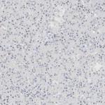 SPT5 Antibody in Immunohistochemistry (IHC)