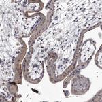 GAPVD1 Antibody in Immunohistochemistry (IHC)