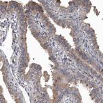 DHPS Antibody in Immunohistochemistry (Paraffin) (IHC (P))