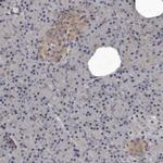 DHPS Antibody in Immunohistochemistry (Paraffin) (IHC (P))