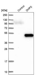 DHPS Antibody in Western Blot (WB)