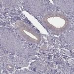 TDRD5 Antibody in Immunohistochemistry (IHC)