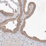 EDEM1 Antibody in Immunohistochemistry (IHC)