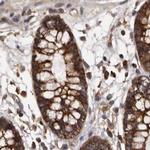 DARS Antibody in Immunohistochemistry (IHC)