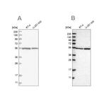 DARS Antibody in Western Blot (WB)