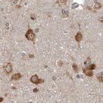 DARS Antibody in Immunohistochemistry (IHC)