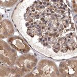 DARS Antibody in Immunohistochemistry (IHC)