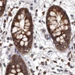 DARS Antibody in Immunohistochemistry (IHC)